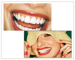 Slider image (3) Angels Touch Dental Care